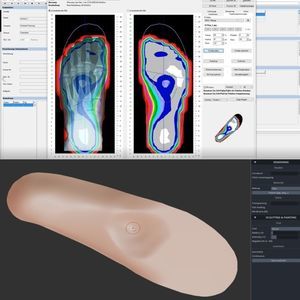 orthopedic insole design software