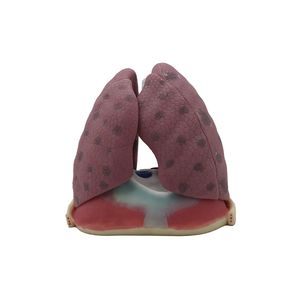 lung model