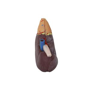 kidney model 1
