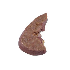 liver anatomical model