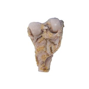 bone anatomical model