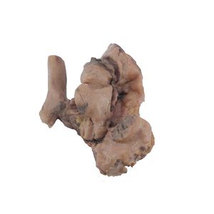 lung model 1