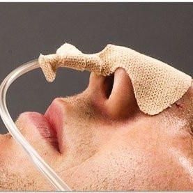 nasogastric tube catheter fixation