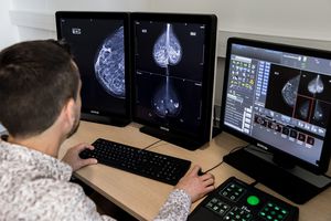 mammography software