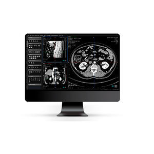 DICOM viewer