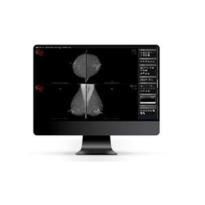 DICOM viewer