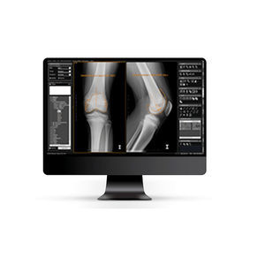 DICOM viewer