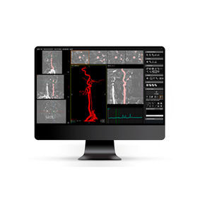 DICOM viewer