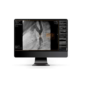 DICOM viewer