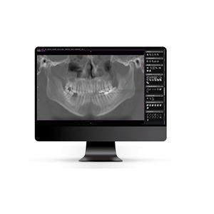 DICOM viewer