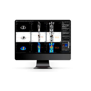 DICOM viewer