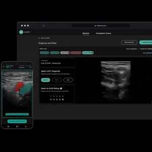 ultrasound imaging software