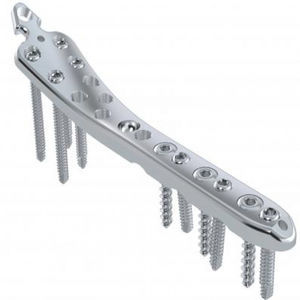 tibia compression plate