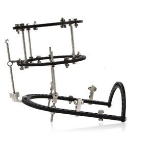 ankle external fixation system