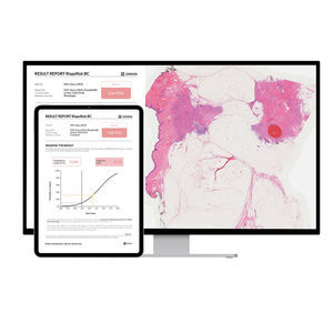 breast cancer screening software