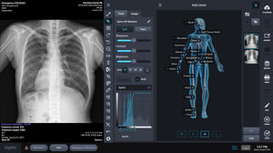 x-ray imaging software