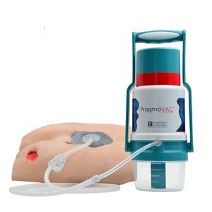 manual negative pressure wound therapy unit