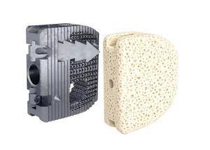 cervical interbody fusion cage 1