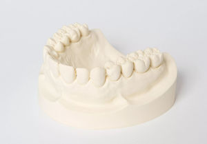 stone dental material