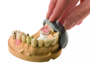 silicone dental material 1