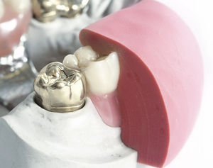 silicone dental material 1