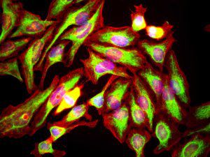 IgG reagent