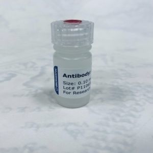 polyclonal antibody