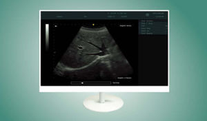 endoscopy display