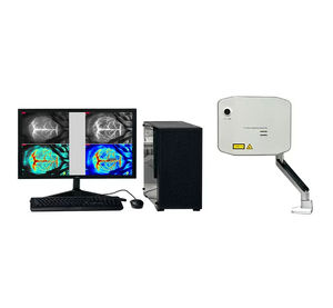 blood flow imaging system 1