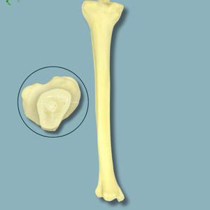 tibia anatomical model
