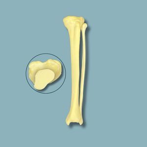 tibia anatomical model