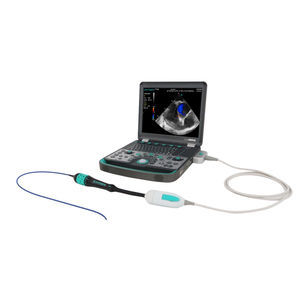 portable ultrasound system