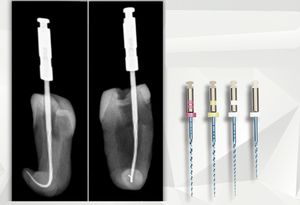 rotary dental file