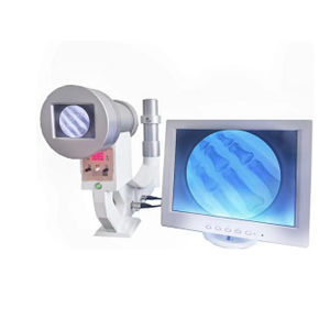 mobile C-arm 1