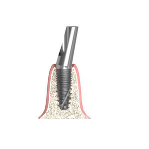 cylindro-conical implant abutment