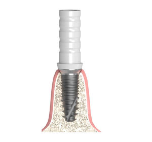 cylindro-conical implant abutment