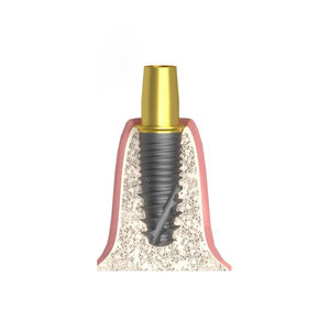 cylindro-conical implant abutment