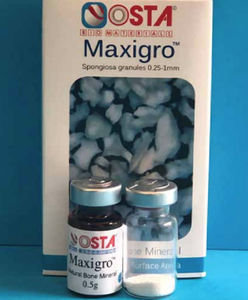 xenograft bone substitute 1