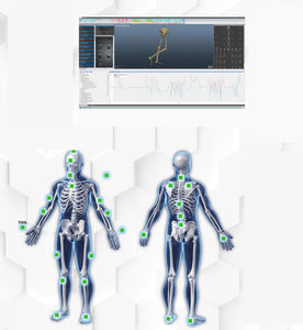 motion assessment system