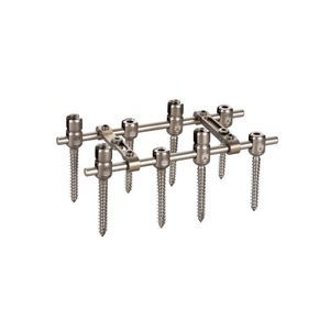 thoraco-lumbar osteosynthesis unit