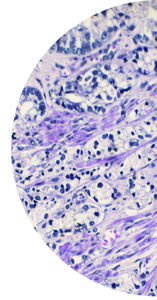 oncology test kit