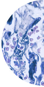 cancer test kit