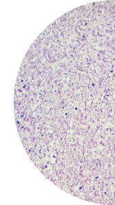 cancer test kit