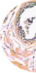 cervical cancer test kit