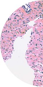 bladder cancer test kit