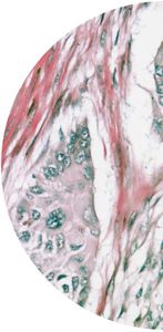 colorectal cancer test kit