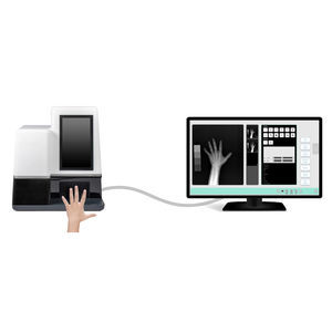 radiography system