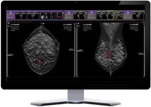 hospital AI platform