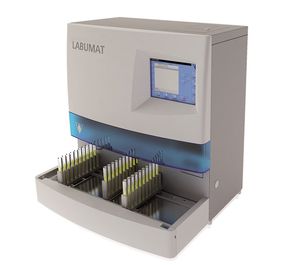 automated urine analyzer