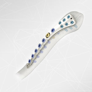 clavicle compression plate 1